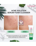 CATHY DOLL ACNE SOLUTION SERUM FOAM CLEANSER - Image 4