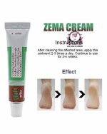 ZEMA CREAM 10 GRAMS - Image 3