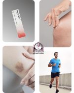 HIRUDOID CREAM 10G - Image 2